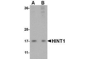 Western blot analysis of HINT1 in Jurkat lysate with AP30394PU-N HINT1 antibody at (A) 1 and (B) 2 μg/ml.