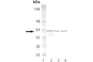 Western blot analysis of HSP60: Lane 1: MW marker, Lane 2: HeLa (Heat Shocked), Lane 3: 3T3 (Heat Shocked), Lane 4: PC-12 (Heat Shocked). (HSPD1 antibody)