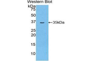 Western Blotting (WB) image for anti-Myosin ID (MYO1D) (AA 512-788) antibody (ABIN1859951) (Myosin ID antibody  (AA 512-788))