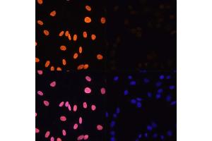 Immunofluorescence analysis of NIH/3T3 cells using Acetyl-Histone H3-K4 antibody (ABIN7267672) at dilution of 1:100. (Histone 3 antibody  (H3K4))