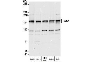 Western Blotting (WB) image for anti-Cyclin G Associated Kinase (GAK) (AA 675-725) antibody (ABIN7453089)