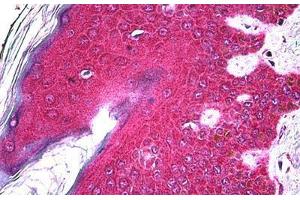 Human Skin: Formalin-Fixed, Paraffin-Embedded (FFPE) (FGFR2 antibody  (AA 621-724))