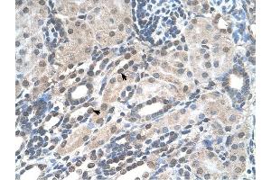 PIGV antibody was used for immunohistochemistry at a concentration of 4-8 ug/ml to stain Epithelial cells of renal tubule (arrows) in Human Kidney.