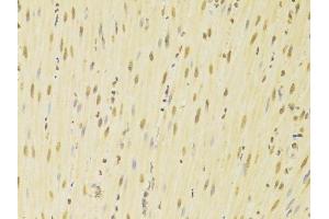 Immunohistochemistry (Paraffin-embedded Sections) (IHC (p)) image for anti-Heterogeneous Nuclear Ribonucleoprotein K (HNRNPK) (AA 1-280) antibody (ABIN3022414)