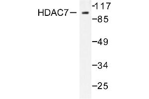 Image no. 1 for anti-Histone Deacetylase 7 (HDAC7) antibody (ABIN265459) (HDAC7 antibody)