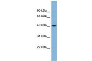 Image no. 1 for anti-serpin Peptidase Inhibitor, Clade I (neuroserpin), Member 1 (SERPINI1) (AA 179-228) antibody (ABIN6741986) (Neuroserpin antibody  (AA 179-228))