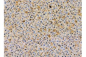 ABIN7095387 and ABIN7099444 at 1/100 staining mouse liver tissue by IHC-P.