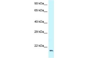 WB Suggested Anti-DCTN3 Antibody Titration: 1.