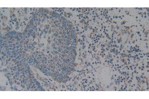 Immunohistochemistry (IHC) image for anti-Complement Component 1, Q Subcomponent Binding Protein (C1QBP) (AA 76-282) antibody (ABIN7432316)