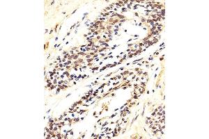 Immunohistochemical analysis of paraffin-embedded H. (AKT 1/2/3 antibody  (AA 278-312))