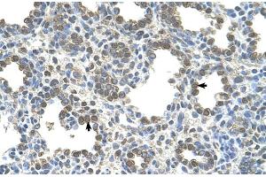 Human Lung (SLC26A5 antibody  (Middle Region))
