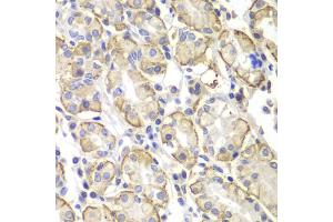 Immunohistochemistry of paraffin-embedded human stomach using Lyn antibody (ABIN4904272) at dilution of 1:100 (40x lens).