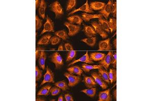 Immunofluorescence analysis of U-2 OS cells using RPS3 antibody (ABIN6128662, ABIN6147219, ABIN6147220 and ABIN6217581) at dilution of 1:100. (RPS3 antibody  (AA 1-243))