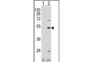 Western blot analysis of FDFT1 (arrow) using rabbit polyclonal FDFT1 Antibody  (ABIN389052 and ABIN2839261). (FDFT1 antibody  (AA 140-170))
