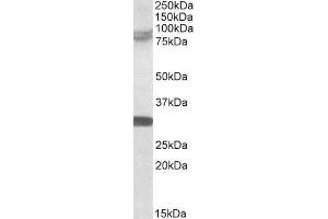 Western Blotting (WB) image for Tripartite Motif Containing 2 (TRIM2) peptide (ABIN370095) (Tripartite Motif Containing 2 (TRIM2) Peptide)