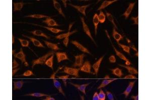 Immunofluorescence analysis of L929 cells using ACAT2 Polyclonal Antibody at dilution of 1:100. (ACAT2 antibody)