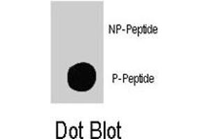 Dot blot analysis of TSC2 (phospho S939) polyclonal antibody  on nitrocellulose membrane. (Tuberin antibody  (pSer939))