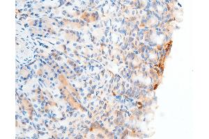 Immunohistochemistry (IHC) image for anti-Checkpoint Kinase 2 (CHEK2) (pSer516) antibody (ABIN6255391)
