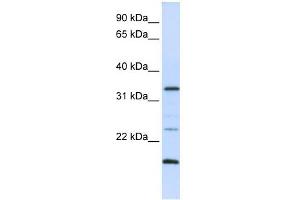 Western Blot showing ARGFX antibody used at a concentration of 1-2 ug/ml to detect its target protein. (ARGFX antibody  (N-Term))