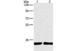 Western Blot analysis of A431 and 231 cell using ARTN Polyclonal Antibody at dilution of 1:350 (ARTN antibody)