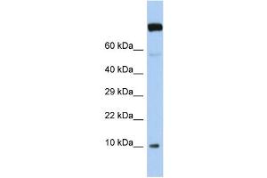 Host:  Rabbit  Target Name:  WBP5  Sample Type:  Jurkat Whole Cell lysates  Antibody Dilution:  1. (WW Domain Binding Protein 5 (WBP5) (N-Term) antibody)