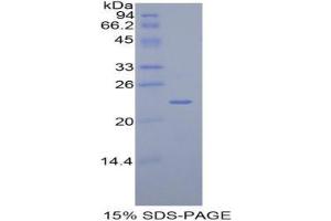 SDS-PAGE analysis of Human Talin Protein. (Talin Protein (TLN))