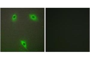 Immunofluorescence analysis of A549 cells, using KLHL3 Antibody. (KLHL3 antibody  (AA 10-59))