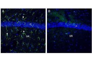 Expression of Otopetrin-1 in mouse hippocampus. (Otopetrin 1 antibody  (4th Cytoplasmic Loop))