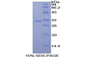 SDS-PAGE analysis of Rat CD2 Associated Protein. (CD2AP Protein)