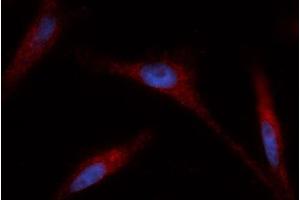 Immunofluorescence (IF) image for anti-Glutaredoxin 1 (GRX1) (AA 1-106) antibody (PE) (ABIN5565554) (Glutaredoxin 1 antibody  (AA 1-106) (PE))
