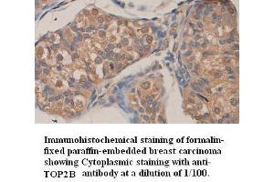 Image no. 1 for anti-Topoisomerase (DNA) II beta 180kDa (TOP2B) (C-Term) antibody (ABIN791099) (TOP2B antibody  (C-Term))