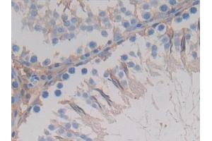 Detection of GSTA4 in Rat Testis Tissue using Polyclonal Antibody to Glutathione S Transferase A4 (GSTA4) (GSTA4 antibody  (AA 2-222))