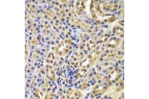 Immunohistochemistry (IHC) image for anti-Nuclear Factor of kappa Light Polypeptide Gene Enhancer in B-Cells Inhibitor, alpha (NFKBIA) (AA 1-317) antibody (ABIN3021668) (NFKBIA antibody  (AA 1-317))