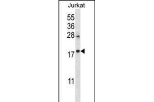 KRT1 Antibody (C-term) (ABIN656288 and ABIN2845597) western blot analysis in Jurkat cell line lysates (35 μg/lane). (KRTAP25-1 antibody  (C-Term))