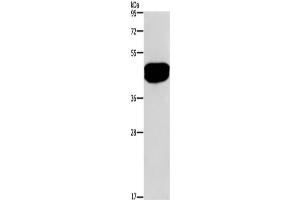 Western Blotting (WB) image for anti-serologically Defined Colon Cancer Antigen 3 (SDCCAG3) antibody (ABIN2421479) (SDCCAG3 antibody)