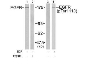 Image no. 2 for anti-Epidermal Growth Factor Receptor (EGFR) (Tyr1110) antibody (ABIN197517) (EGFR antibody  (Tyr1110))