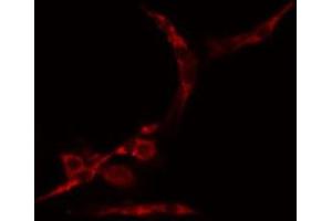 ABIN6274991 staining Hela cells by IF/ICC. (CEP70 antibody  (Internal Region))