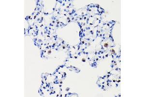 Immunohistochemistry of paraffin-embedded rat lung using [KO Validated] Cyclin D1 Rabbit mAb (ABIN7266561) at dilution of 1:100 (40x lens). (Cyclin D1 antibody)