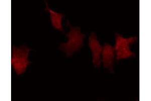 ABIN6269367 staining HeLa by IF/ICC. (NFKBIB antibody  (N-Term))