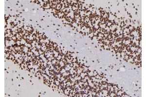 ABIN6276809 at 1/100 staining Rat brain tissue by IHC-P. (CDC25C antibody  (Internal Region))