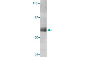 Western blot analysis of IL21R expression in human Raji cell lysate with IL21R polyclonal antibody  at 1 ug /mL . (IL21 Receptor antibody  (AA 20-32))