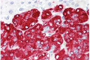 Image no. 2 for anti-Ring Finger Protein 139 (RNF139) (AA 72-121) antibody (ABIN6749727) (RNF139 antibody  (AA 72-121))