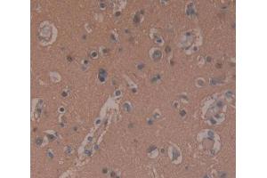 #VALUE! (PDE10A antibody  (AA 508-779))