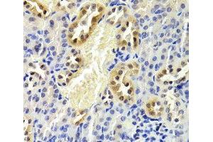 Immunohistochemistry of paraffin-embedded Mouse kidney using CDKN1B Polyclonal Antibody at dilution of 1:200 (40x lens). (CDKN1B antibody)