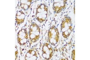 Immunohistochemistry of paraffin-embedded human colon using ERLIN1 antibody (ABIN7267005) at dilution of 1:100 (40x lens).