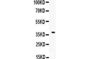Anti- CD86 Picoband antibody, Western blotting All lanes: Anti CD86  at 0. (CD86 antibody  (AA 24-329))