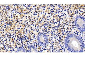 Detection of FAS in Human Appendix Tissue using Polyclonal Antibody to Factor Related Apoptosis (FAS) (FAS antibody)