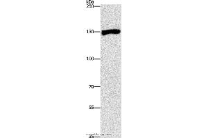 Western blot analysis of Raji cell, using UPF1 Polyclonal Antibody at dilution of 1:300 (RENT1/UPF1 antibody)
