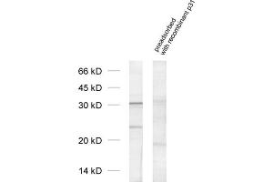 dilution: 1 : 1000, sample: cell lysate from Jurkat cells (PSMD8 antibody  (AA 4-232))