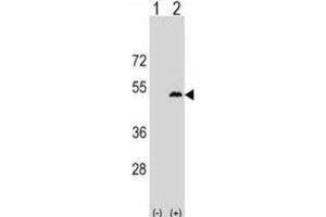 Western Blotting (WB) image for anti-Leupaxin (LPXN) antibody (ABIN2999719)